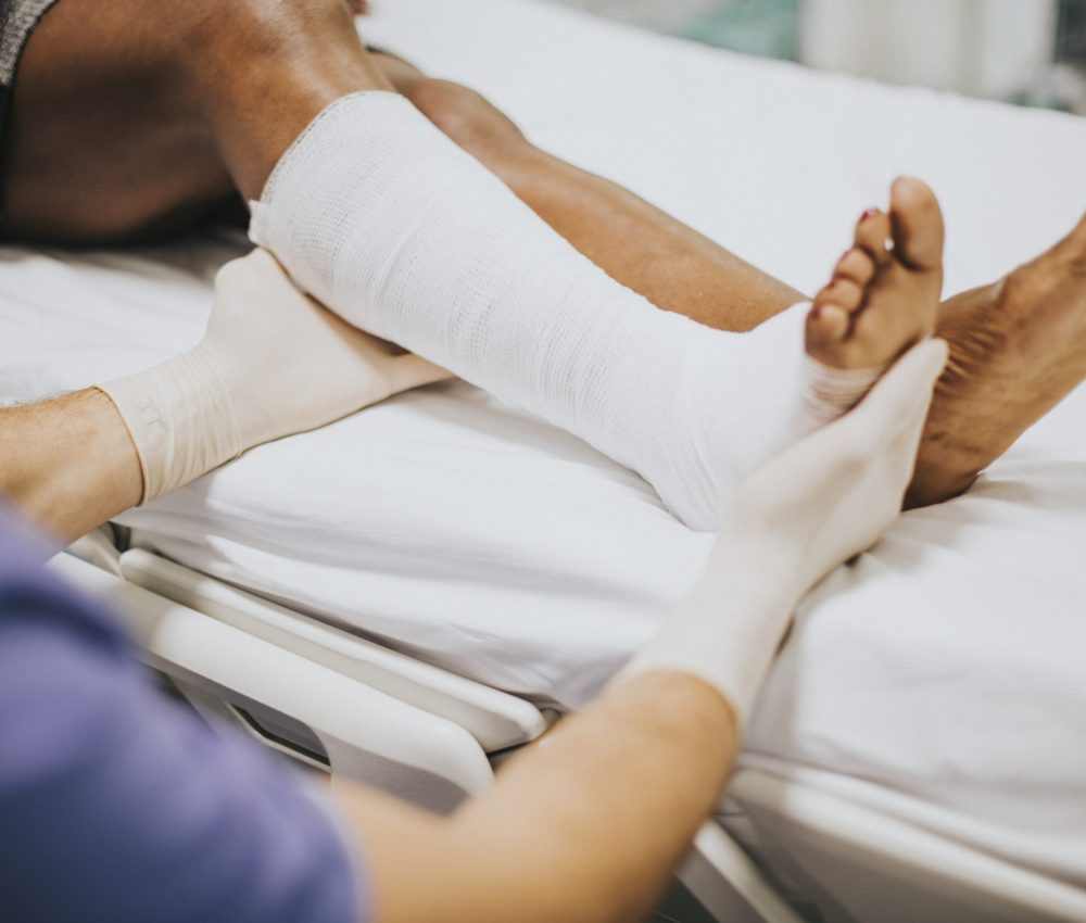 Doctor helping a patient with a fractured leg Doctor helping a patient with a fractured leg